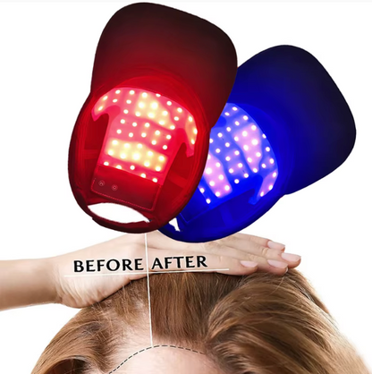 Casquette Luminothérapie Capillaire